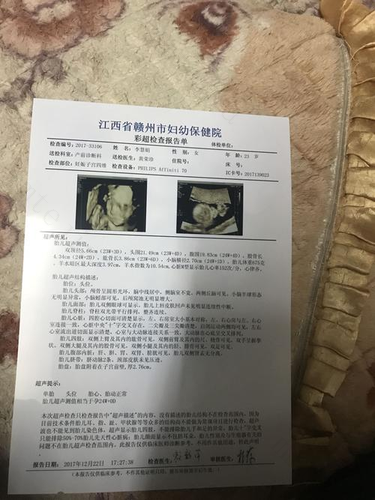 从彩超看生男生女,赶紧拿起彩超看看吧 从彩超看生男生女,赶紧拿起彩超看看吧