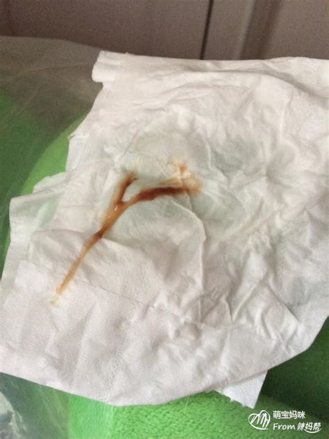 排卵期白带会增多吗