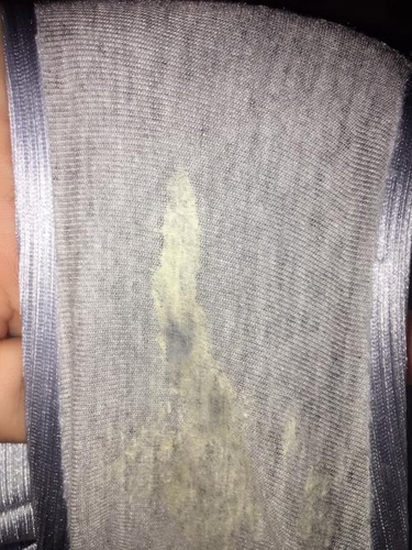 女性白带增多要紧吗 女性白带增多要紧吗