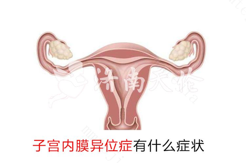 女性不孕要检查什么 首先排除子宫内膜异位症