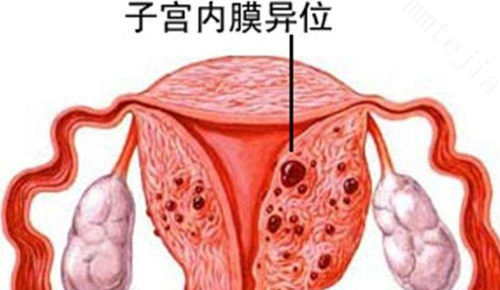 哪些不孕适合接受辅助生育 哪些不孕适合接受辅助生育