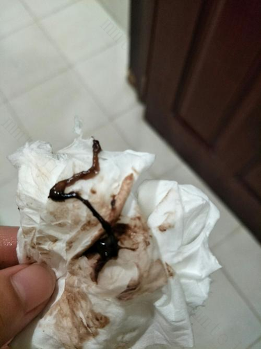 怀孕,补出来的流产 怀孕,补出来的流产