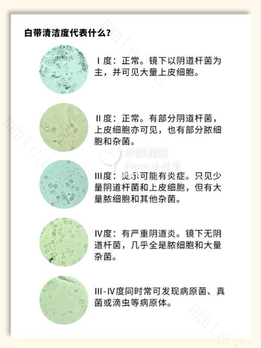 白带清洁度3度是什么意思