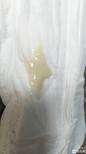 白带没有正常吗