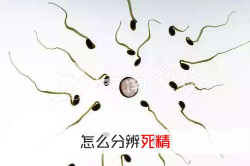 精子胶冻状是死精吗 精子胶冻状是死精吗