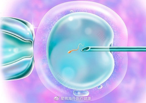人工授精知多少