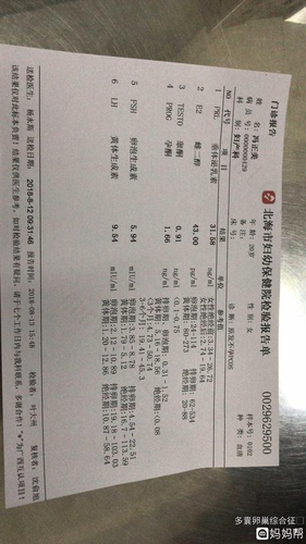 男性睾酮高的表现 男性睾酮高的表现