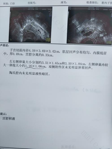 卵巢有卵泡说明什么