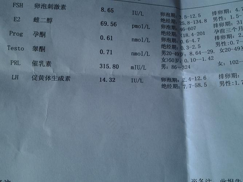 促黄体生成素高怎么降 促黄体生成素高怎么降