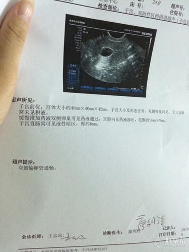 卵泡多大可以受孕