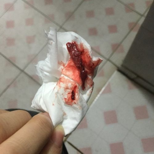 月经连续来十几天怎么回事