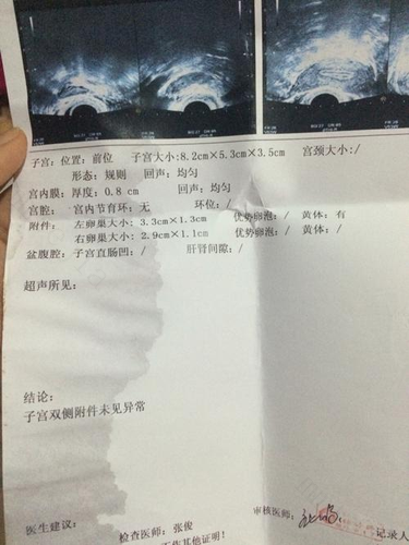 促排卵治疗会提前绝经？来看看专家怎么说！