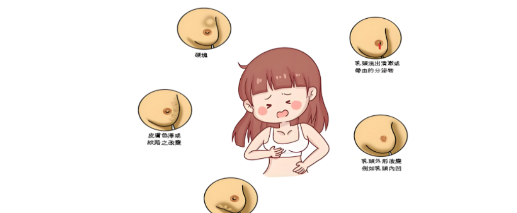 乳腺癌的3类诱因，看看你有没有中招！