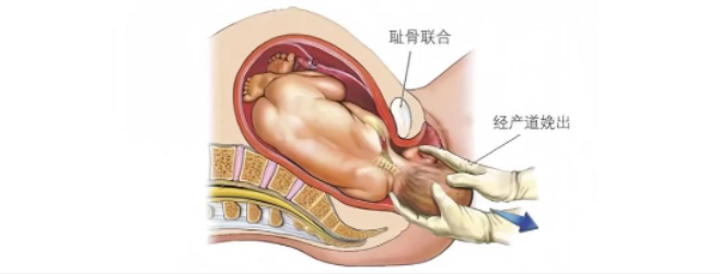 90%产妇这个地方痛，原因找到了，后悔没早点知道！
