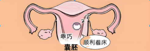 9f491113-b694-45e4-8b9e-ad97e903aba1.png