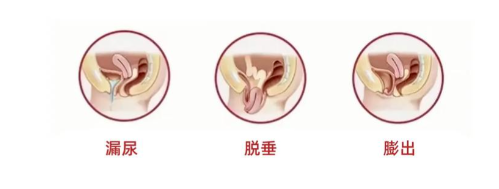 804b96f6-d35d-4a84-81ee-a231a16b9c15.png