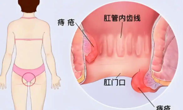 产后用力排便,子宫真的会下垂吗?医生不说透的“温和通便法”全