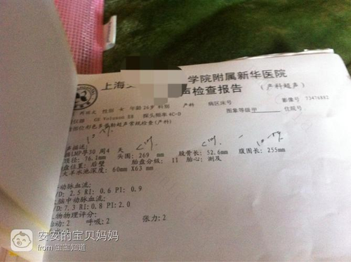 科学保胎如何做？给你说个又便宜又省钱的办法，别上不良商家的当 有什么保胎的好办法吗