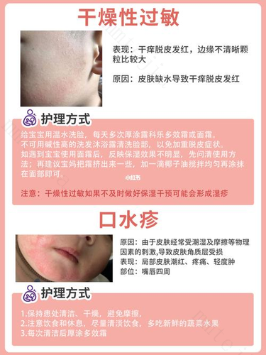 5个宝宝皮肤护理指南，让孩子瞬间拥有“牛奶肌”，新手妈咪必看 新生儿皮肤护理指南