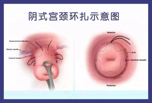 怀孕几个月小孩子会四肢长全？ 怀孕几个月孩子长出四肢