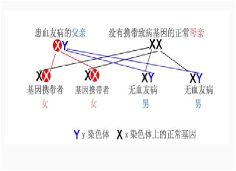 哪些疾病会遗传给女儿？想要女孩的家长要小心 哪些疾病会遗传给女儿