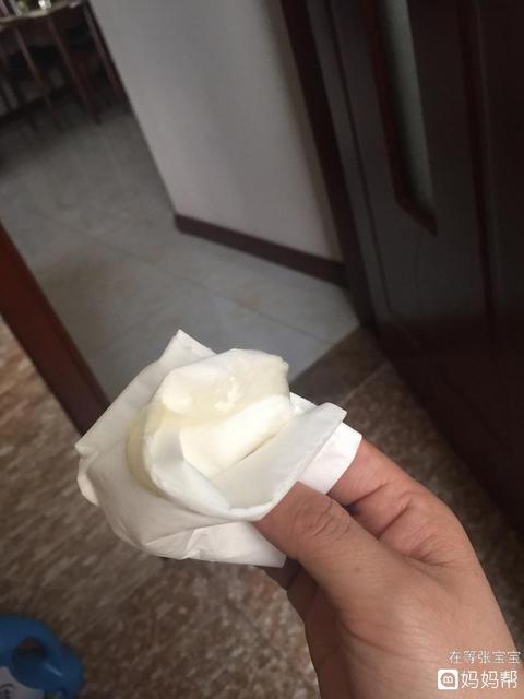 排卵期有哪些症状？白带会出现拉丝 排卵期出血会有拉丝症状吗